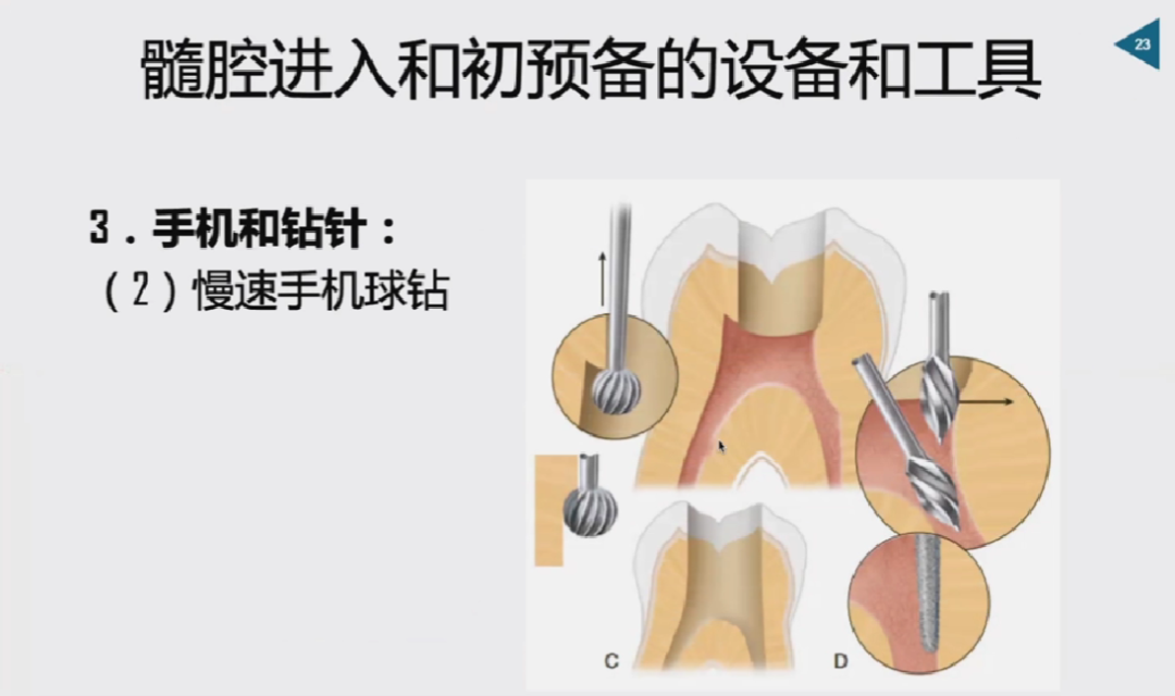 慎始如终：做好根管治疗的第一步