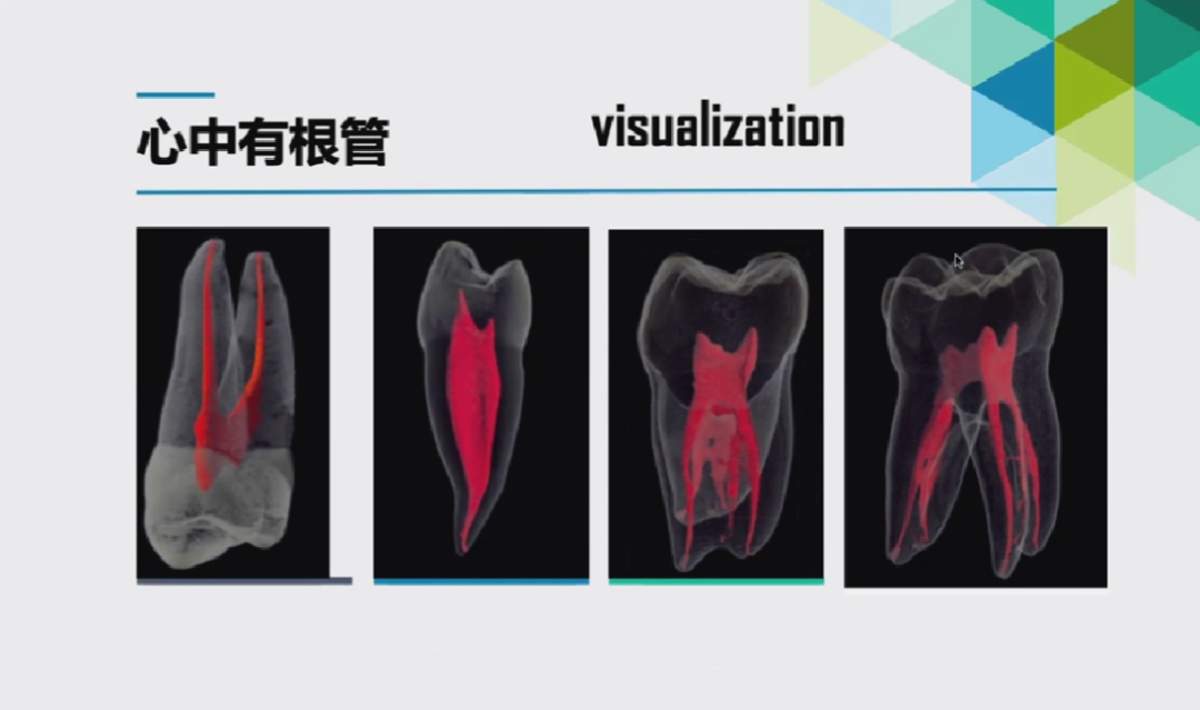 慎始如终：做好根管治疗的第一步