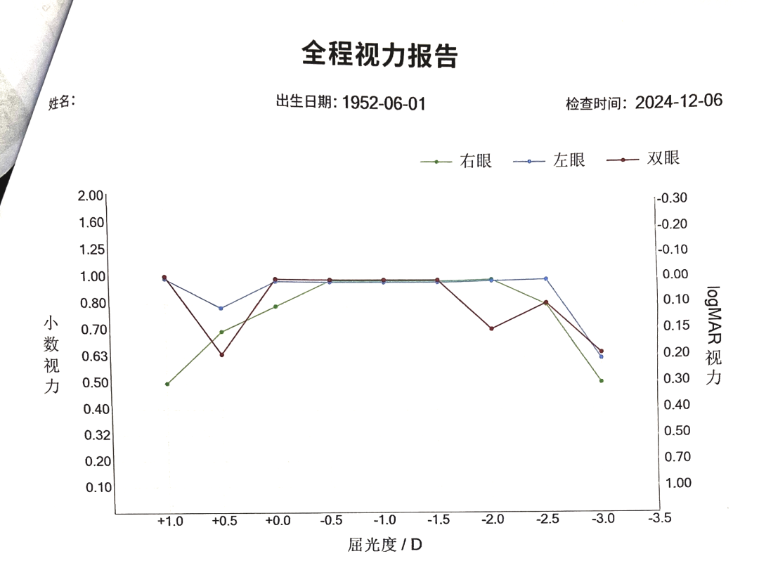 新无级EDOF人工晶状体植入术后半年随访