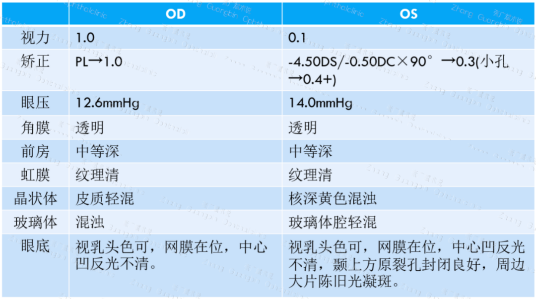 病历分享｜白内障术后罕见并发症-CRAO