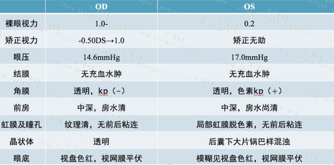 病历分享｜并发症白内障诊疗一例