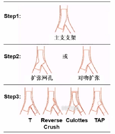 介入笔记