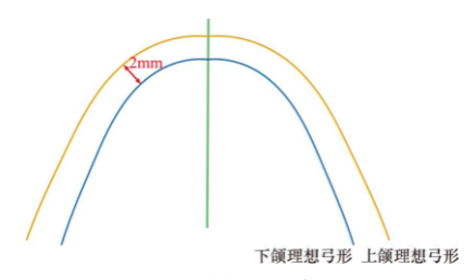 正畸治疗可视化（VTO）操作步骤