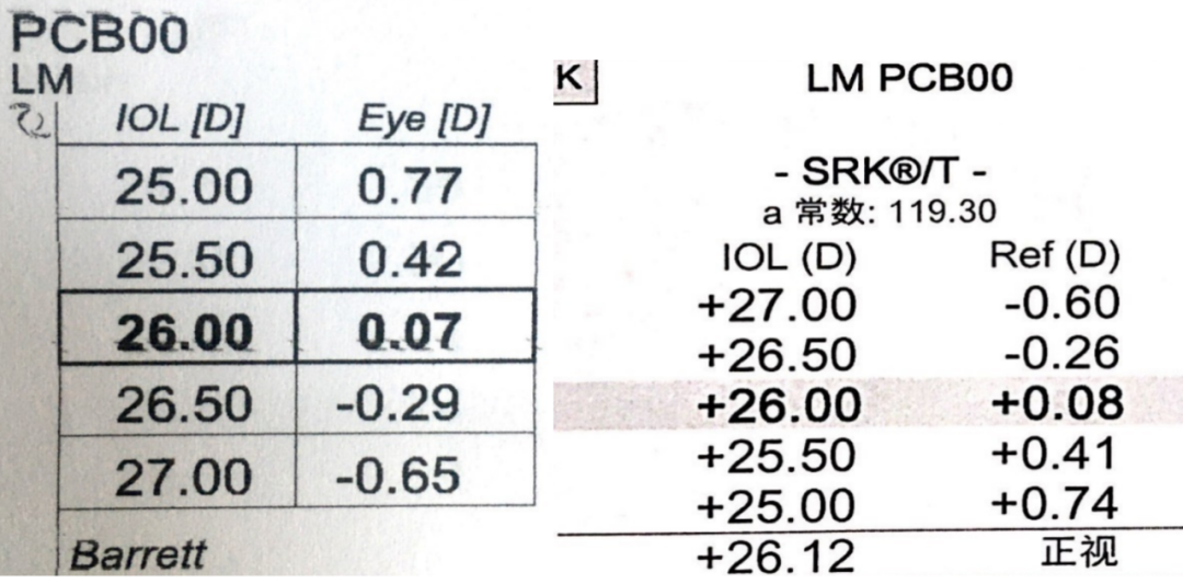 病例分享｜人工晶体植入术后屈光意外原因及处理