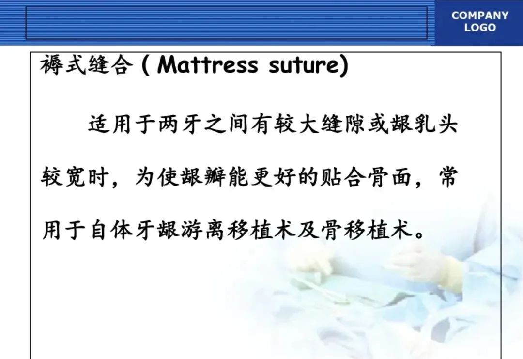 翻瓣手术如何做,看完这篇手术思路更清晰!