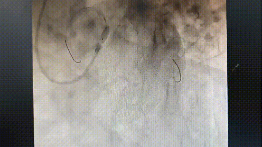 Launcher病例荟