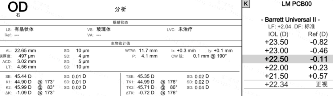 病例分享丨多焦点IOL植入术后视觉障碍处理：晶体置换
