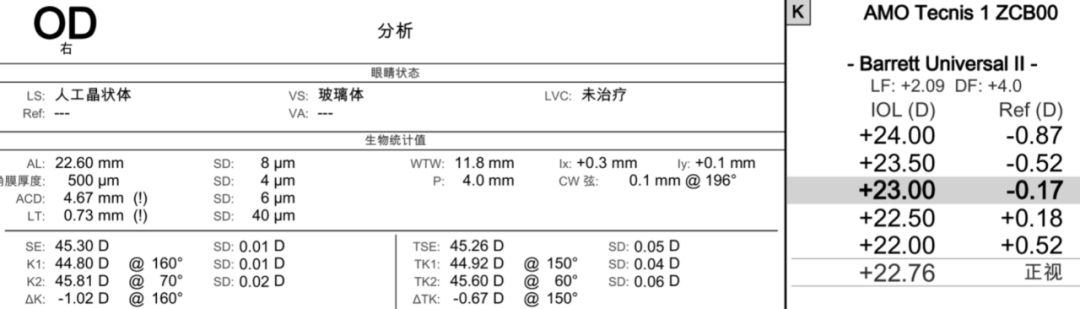 病例分享丨多焦点IOL植入术后视觉障碍处理：晶体置换