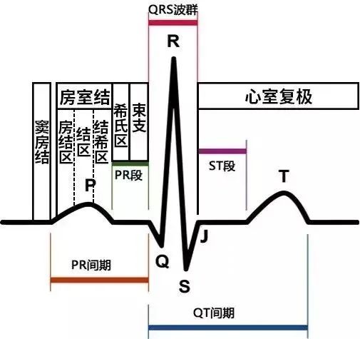 急性心梗心电图各阶段特点