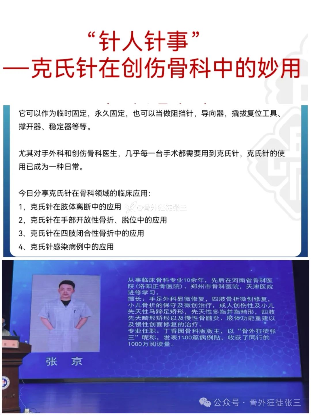“针”人“针”事----万能克氏针在创骨科的应用