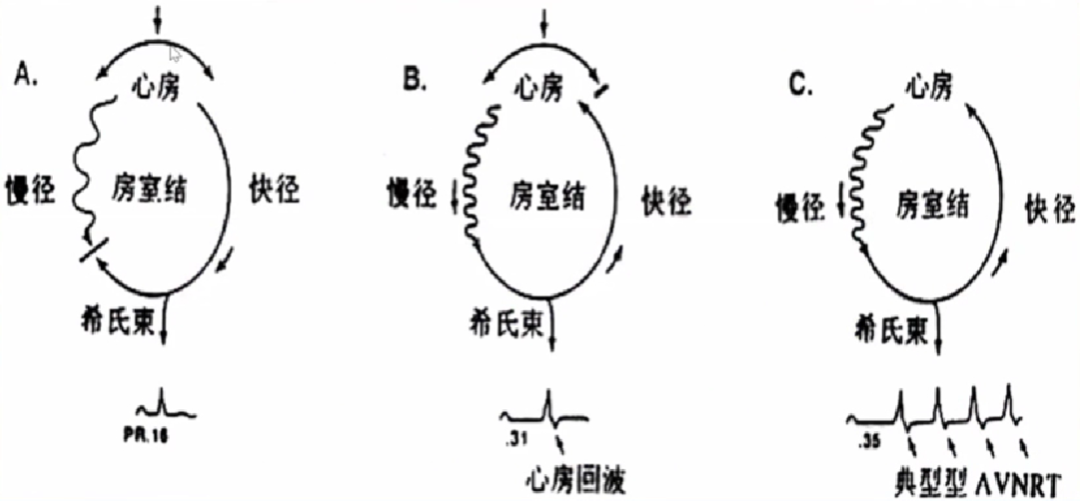 【心律解码】心律失常的诊断与治疗，很全很实用！