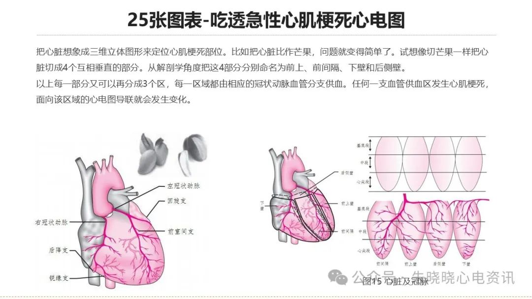 25张图表吃透急性心肌梗死心电图