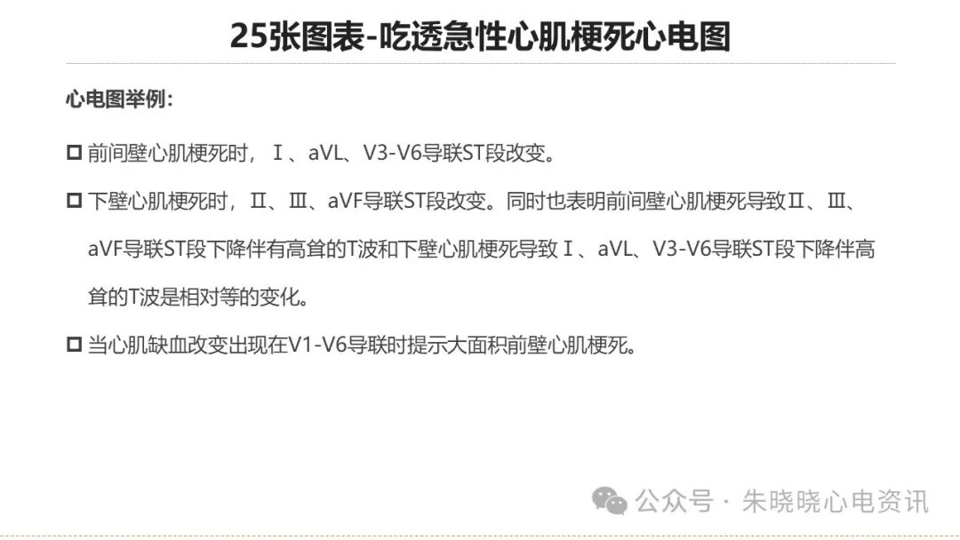 25张图表吃透急性心肌梗死心电图