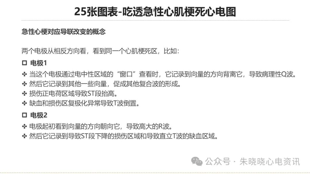 25张图表吃透急性心肌梗死心电图