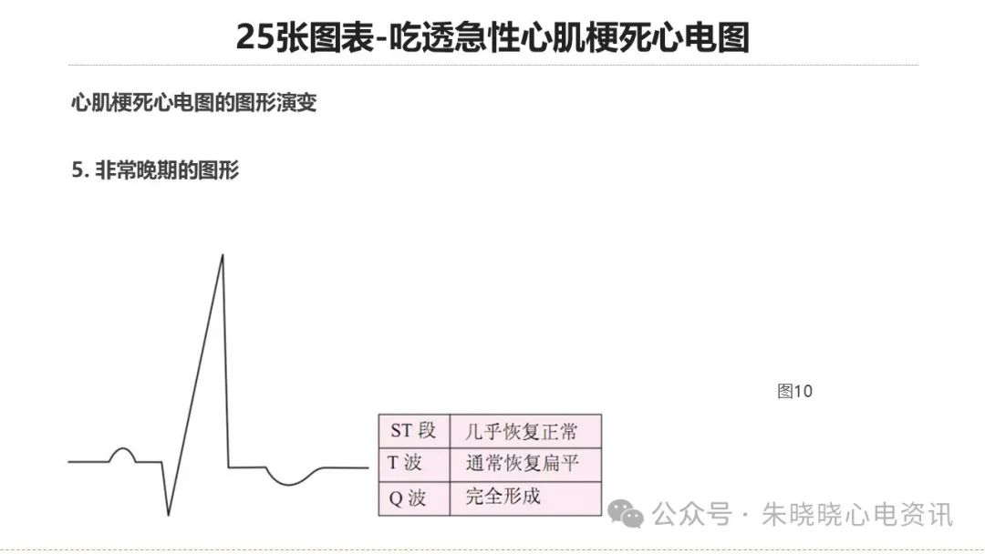 25张图表吃透急性心肌梗死心电图