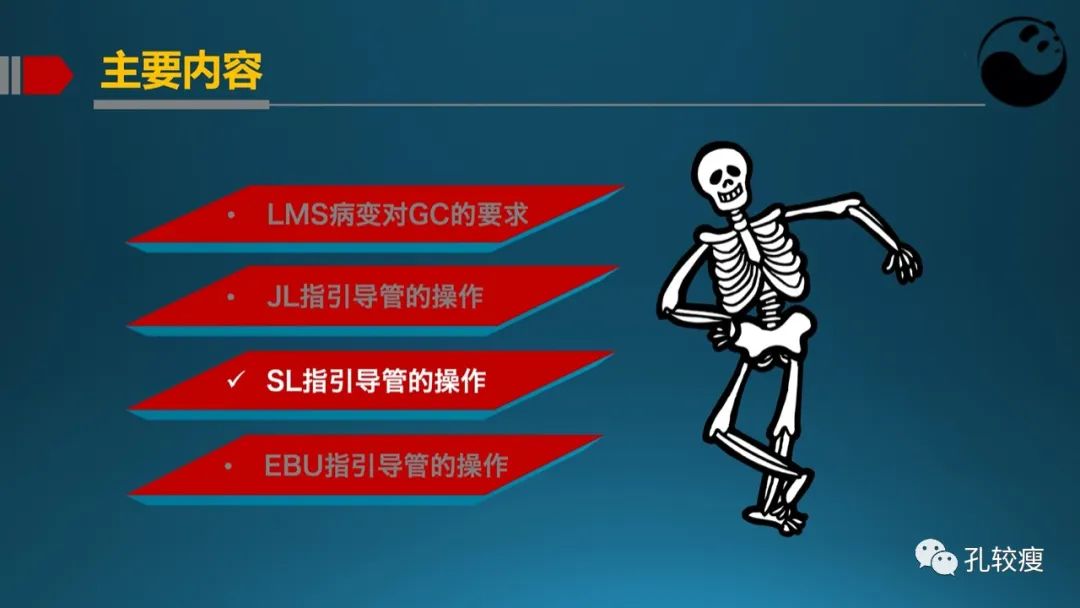 左主干指引导管的选择