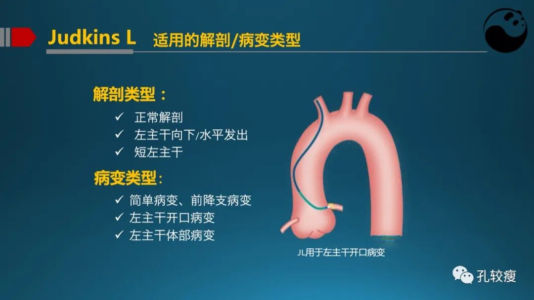 左主干指引导管的选择