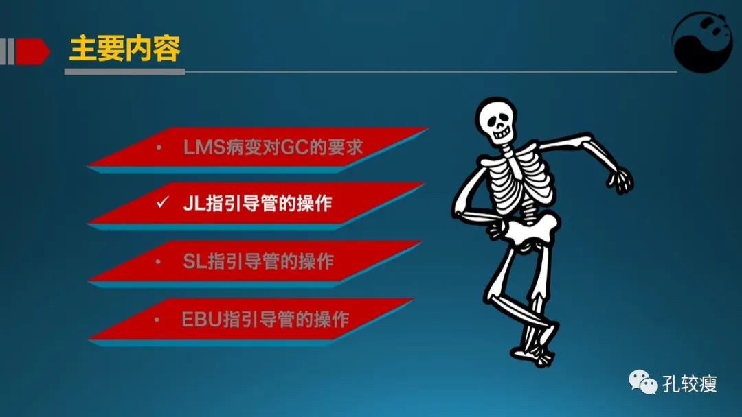 左主干指引导管的选择