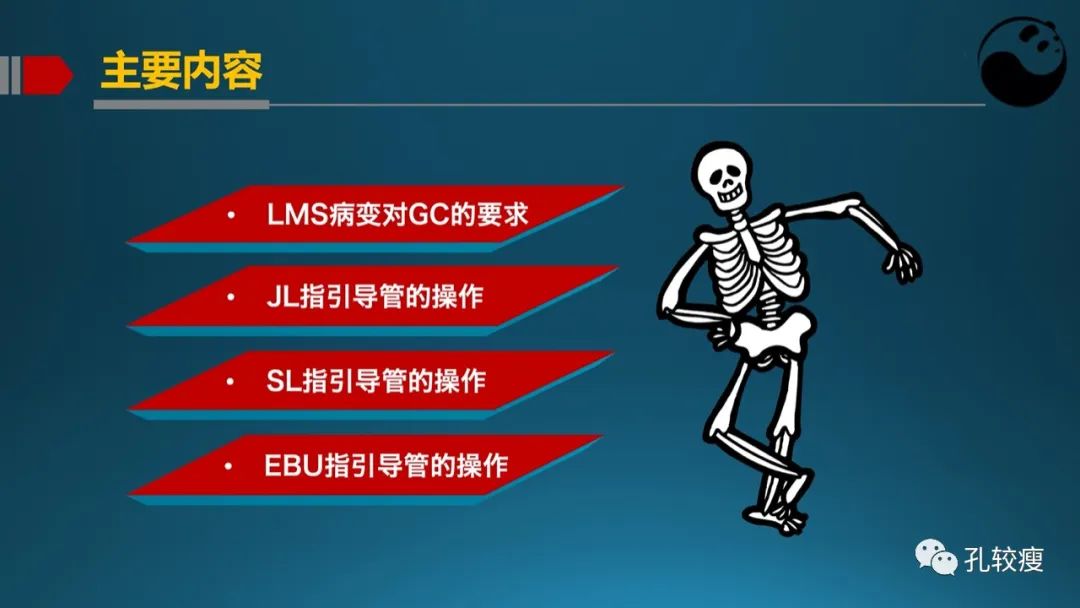 左主干指引导管的选择