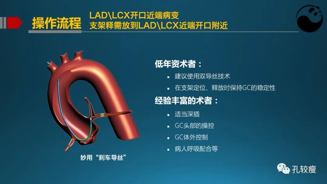 左主干指引导管的选择
