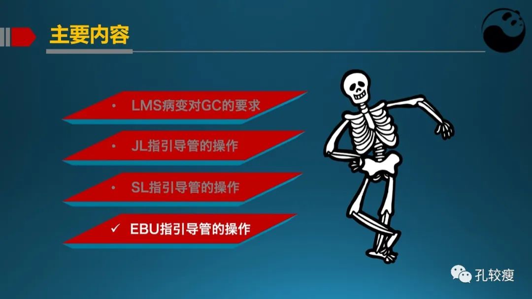 左主干指引导管的选择