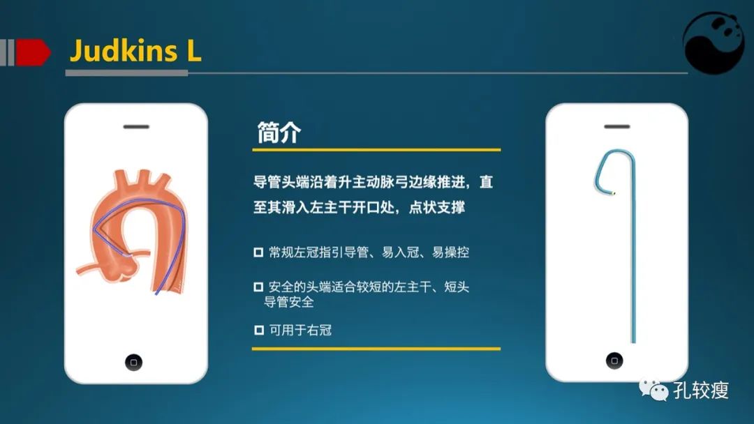 左主干指引导管的选择