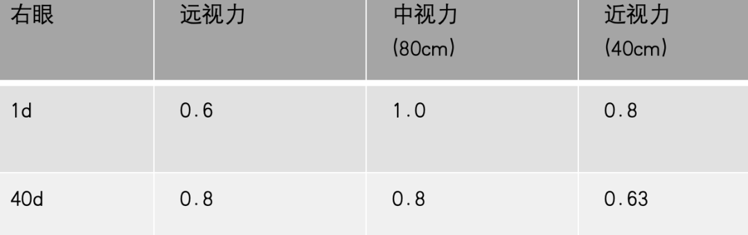 病历分享丨LASIK术后双眼平衡手术规划