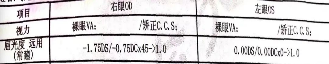 病历分享丨LASIK术后双眼平衡手术规划