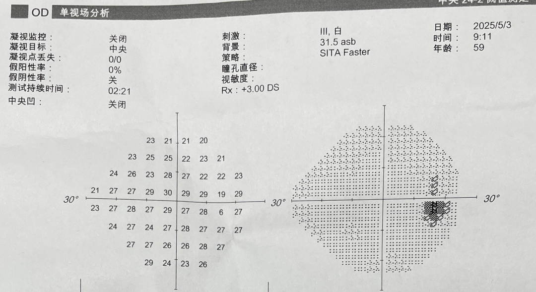 白内障术后视力为什么没有增加？