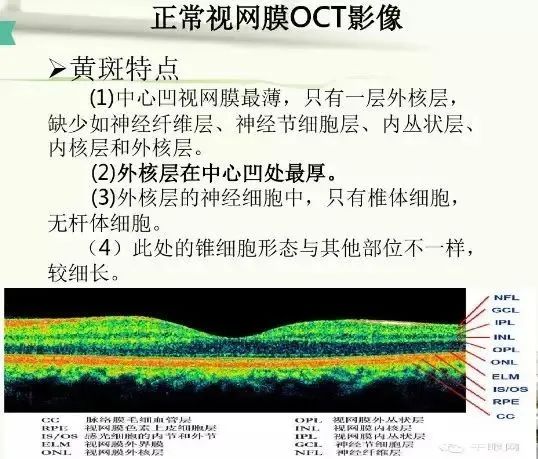 常见OCT影像及图像解读