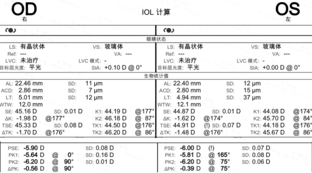 病历分享丨屈光白内障手术病例