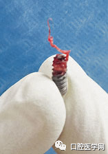 忘调转速,植体撕裂神经