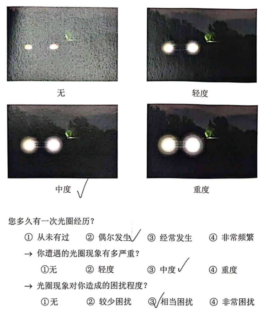 病例分享｜屈光白内障术后
