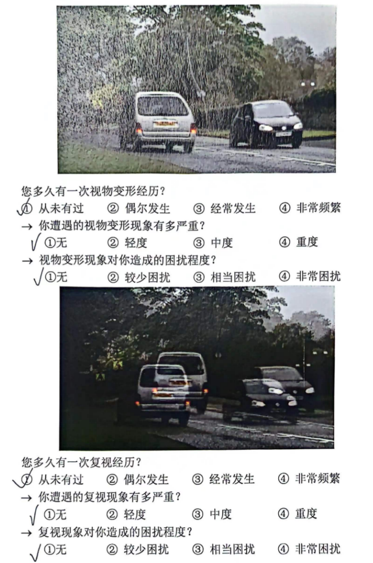 病例分享｜屈光白内障术后