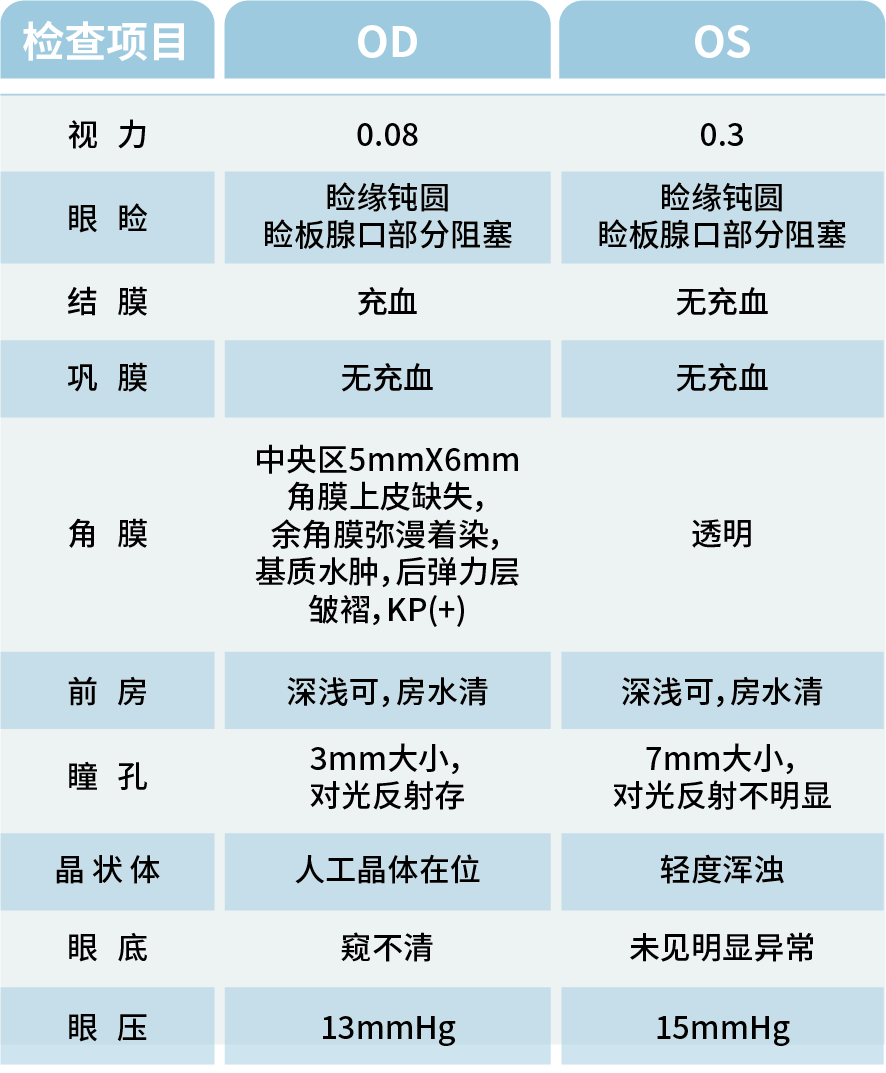 白内障术后的意外插曲：角膜水肿之扰
