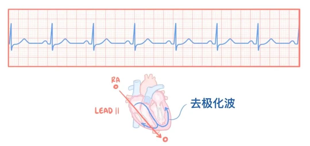 心电图原来可以这样看：省心！
