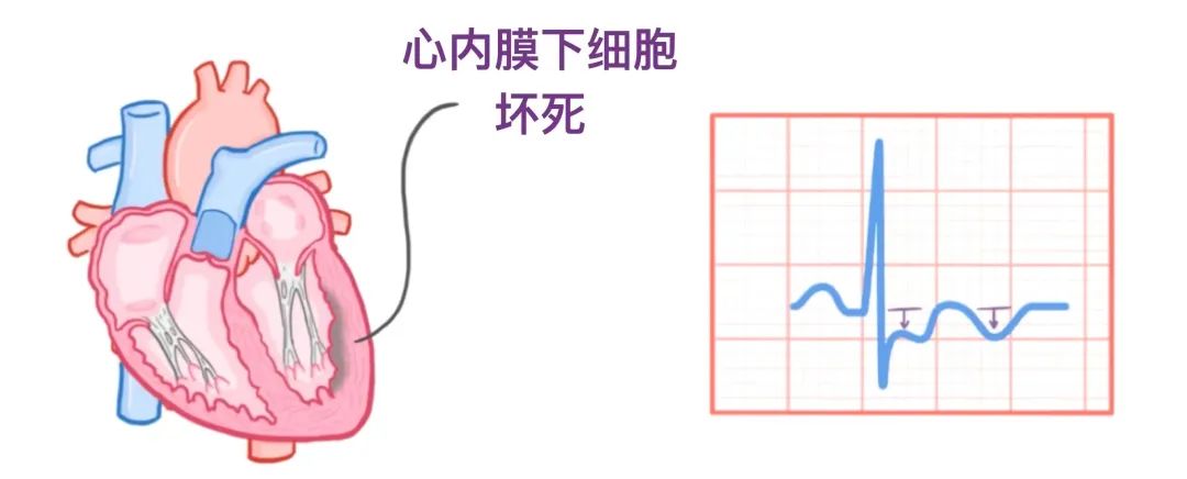 心电图原来可以这样看：省心！
