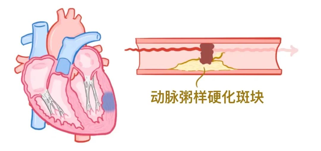 心电图原来可以这样看：省心！