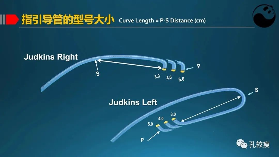 指引导管的选择和操作