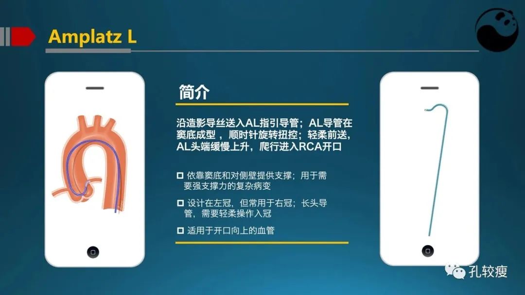 指引导管的选择和操作