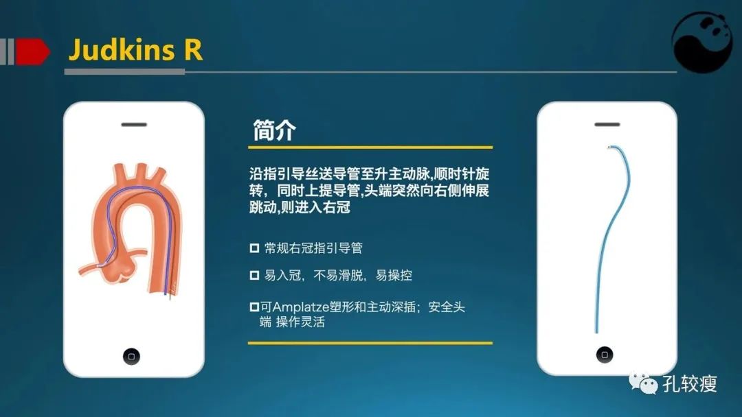 指引导管的选择和操作