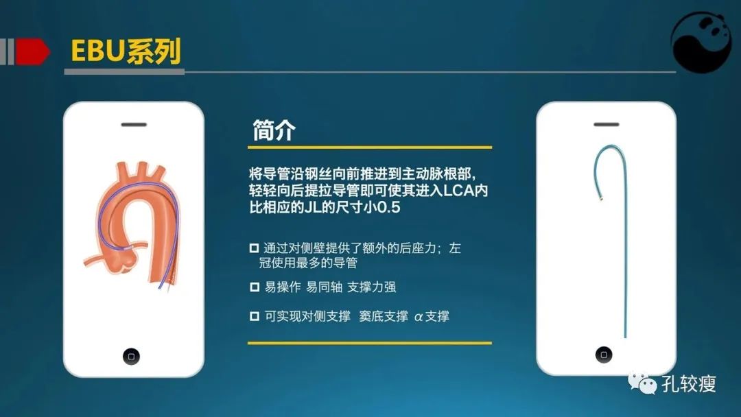 指引导管的选择和操作