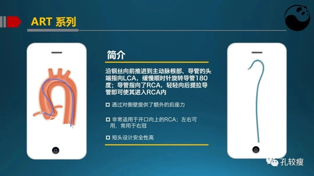 指引导管的选择和操作