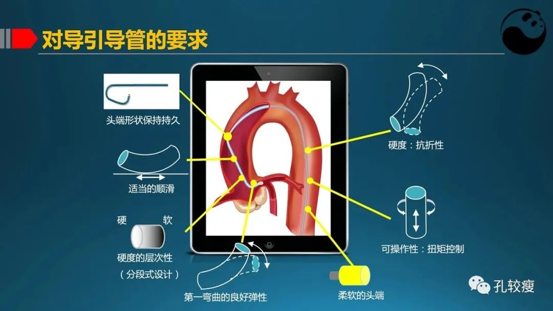 指引导管的选择和操作