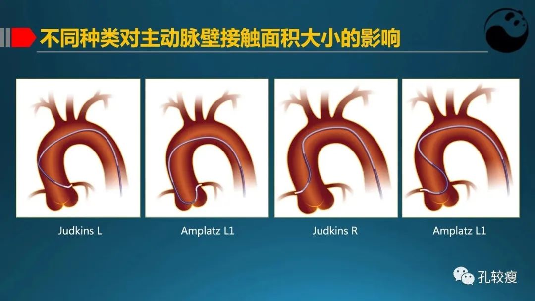 指引导管的选择和操作