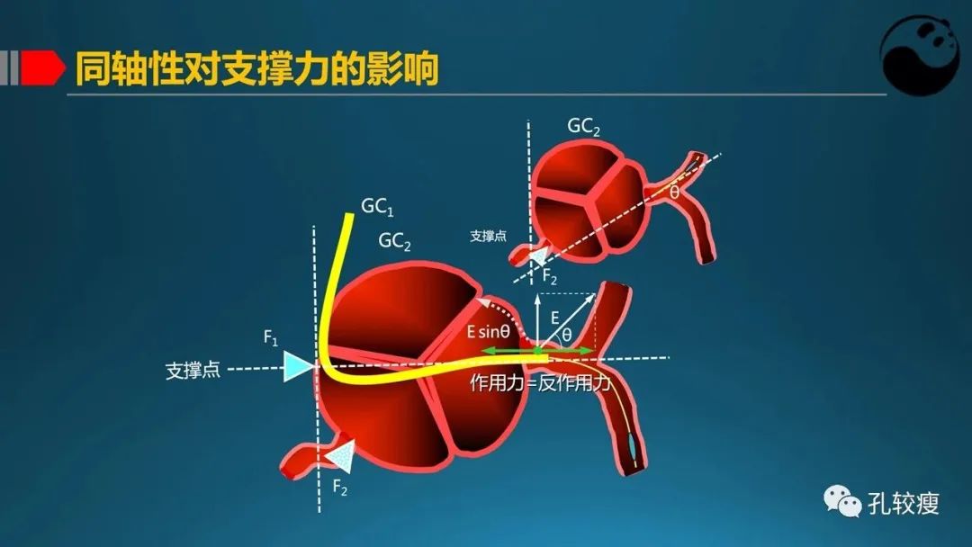 指引导管的选择和操作