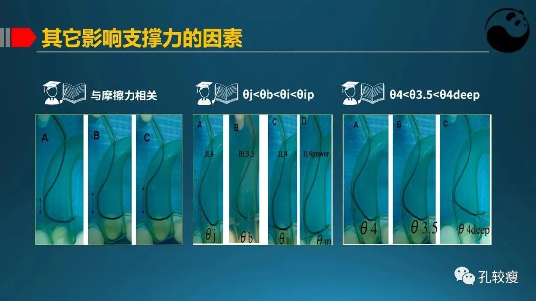 指引导管的选择和操作