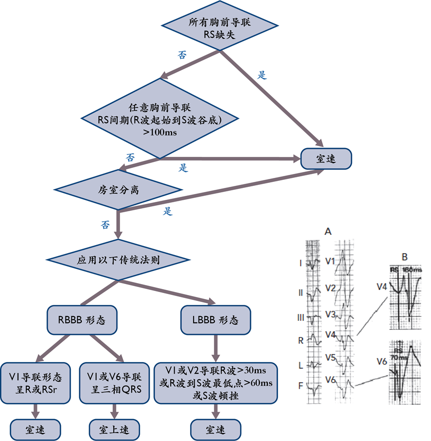 这3种病，都表现为『宽QRS波心动过速』！