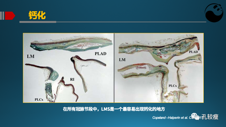 为什么说左主干是一个特殊的分叉