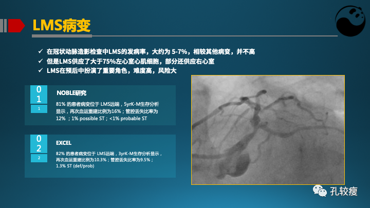 为什么说左主干是一个特殊的分叉